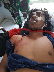 Randi Meninggal Akibat Peluru Tajam yang Mengenai Pembungkus Jantungnya