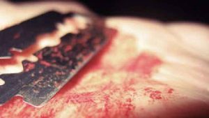 Suami Penyilet Wajah Istri di Konut Segera Disidang, Sanksi Lima Tahun Penjara Menanti 