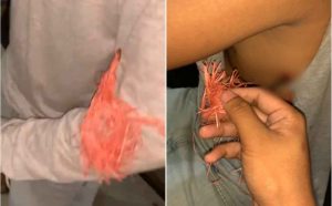 Usai Antar Penumpang, Tukang Ojek Kena Busur, Sebut Pelaku Mengendarai Mobil