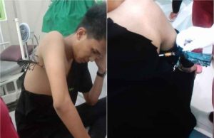 Asik Nongkrong di JTK, Ajis Dilarikan ke RSUD Kendari Dengan Punggung Berdarah