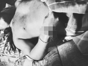 Beredar Foto Jasad Nelayan Korban Penembakan Oknum Polisi di Laonti, Tangan Kanan Hampir Putus