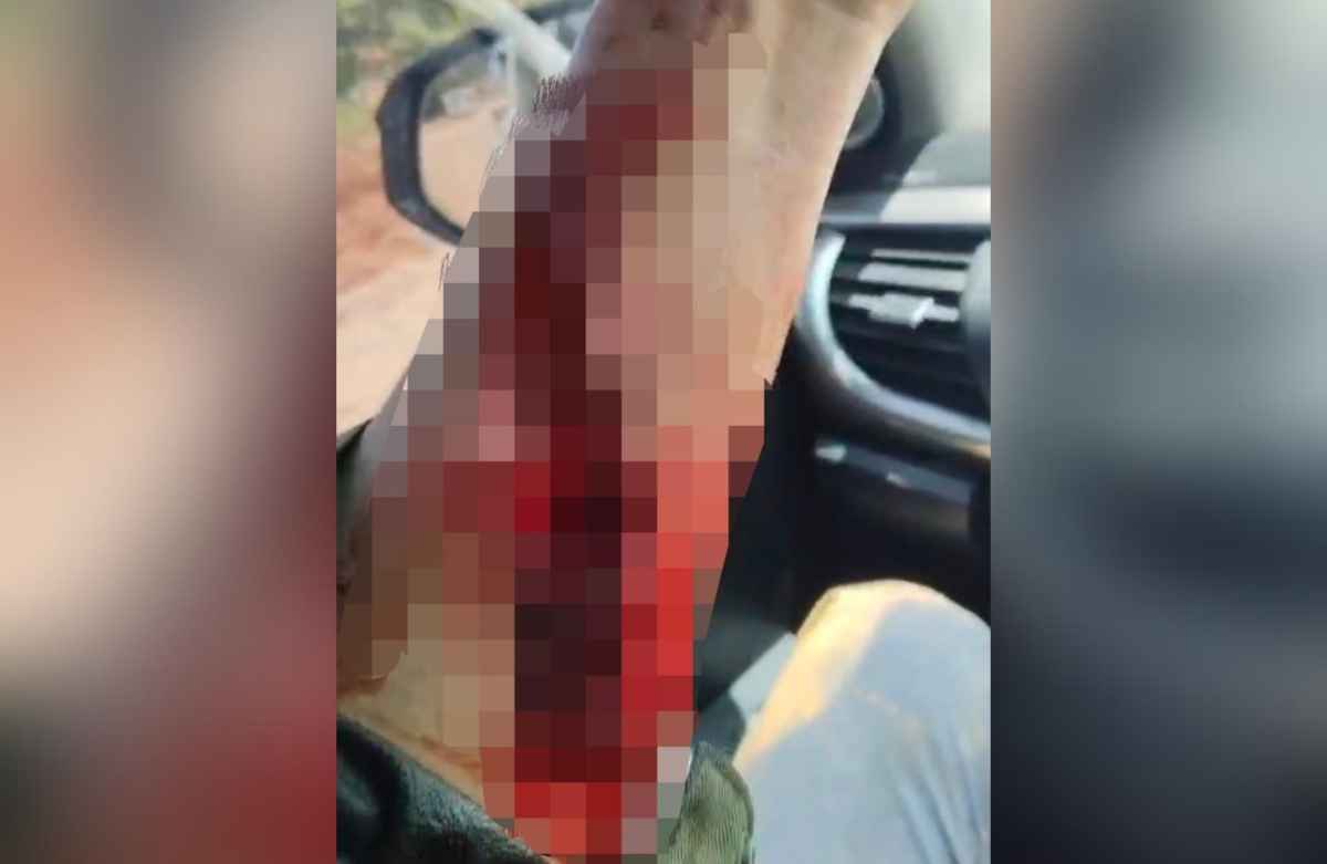 Pekerja PT Toshida Dianiaya Sajam, Gangguan Kamtibmas di Area Tambang Pomala Kian Mengkhawatirkan