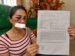 Cekcok, Wajah Wanita di Wua-wua Memar Dibogem Pacarnya
